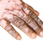 shutterstock_224742421-1-150x150_cdbe2c782f8adad3a4b60e85a6918a7e